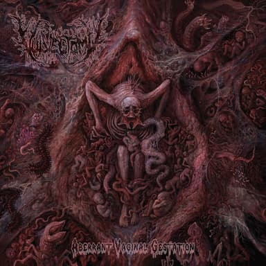 Vulvectomy